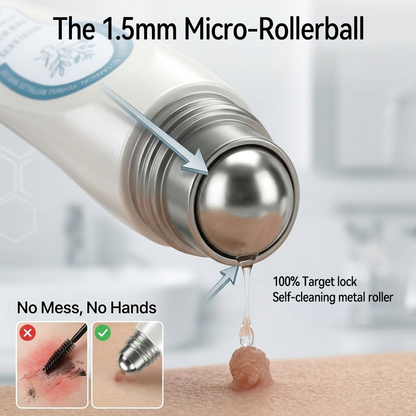 Treatskina®🌿 Official Store7-𝐷𝑎𝑦 𝗧𝐚𝐠 & 𝗦𝗽𝐨𝐭 𝐄𝐫𝒂𝒔𝒆𝒓(Zero Pain, Zero 𝐒𝐜𝐚𝒓𝒔 Rollerball)